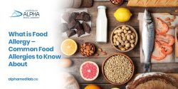 What Is Food Allergy? – 6 Common Food Allergies To Know About