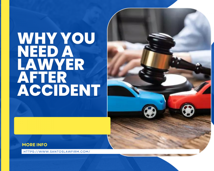 Why You Need A Lawyer After An Accident
