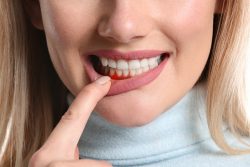 An Overview of Dental Abscesses — Doctor In Uptown