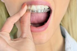 Veneers Gap Teeth | Will Veneers Fix Gap Teeth? – Dentist – Newington, CT
