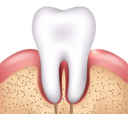 Wisdom Tooth Removal Houston TX | Wisdom Teeth / Oral Surgery in Houston, TX
