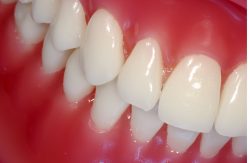 Cosmetic Dentist in Houston TX | Cosmetic Dentistry