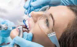 Dental Veneers VS Lumineers Cost | Lumineers Before And After | dentisthoustontx