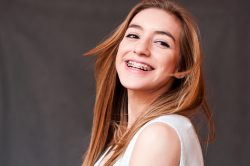 Choose The Best Colors For Your Braces | How to Pick the Best Braces Color for Your Teeth