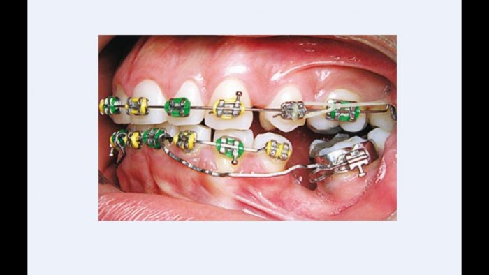 Orthodontist In Aventura Florida | Orthodontist in Aventura