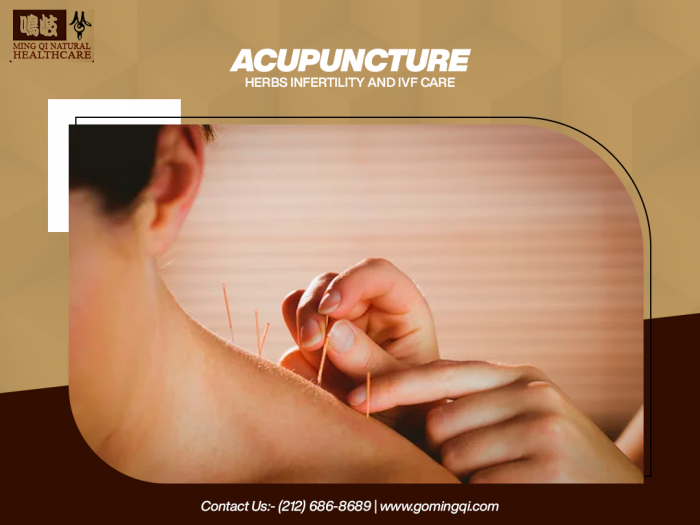 Acupuncture Herbs Infertility and IVF Care image