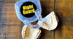 Custom Mouth Guard for Grinding Teeth