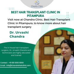 Best Hair Transplant Clinic in Pitampura – Chandra Clinic