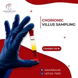 Chorionic Villus Sampling