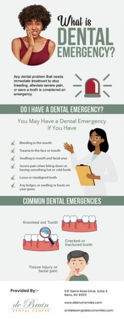Choose our Dentist at de Bruin Dental Center in Reno, NV for Emergency Treatment
