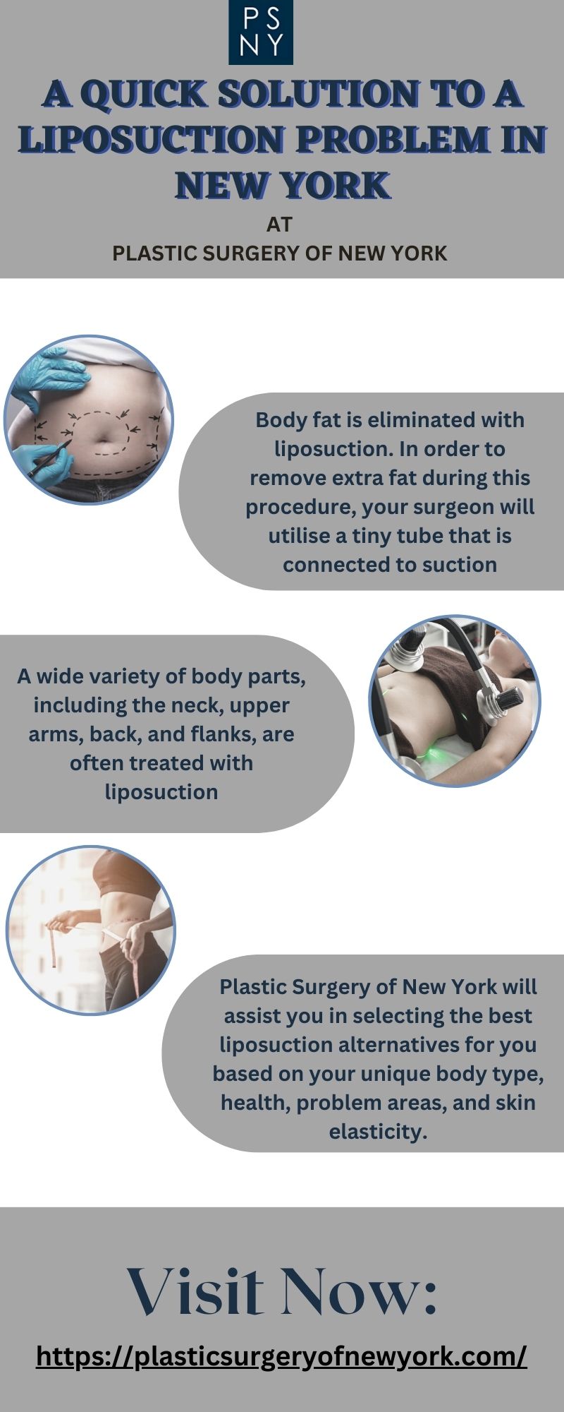 Top Liposuction NYC for Weight Loss : Plastic Surgery of New York