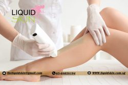 Hair Removal Services in Singapore