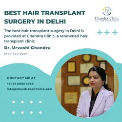 Receive Best Hair Transplant Surgery in Delhi – Chandra Clinic
