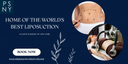 The Best Liposuction Surgery In New York For Body Shaping
