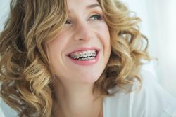 Clear Teeth Aligners In Houston, Tx | Invisalign Clear Aligners