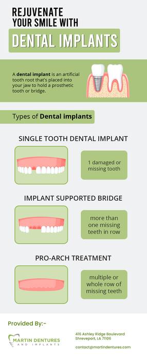 Restore your Natural Smile with Dental Implants from Martin Dentures and Implants in Shreveport, LA