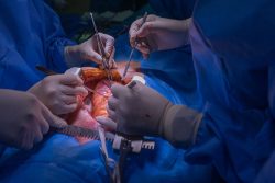 When is Open-Heart Surgery Performed?