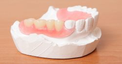 Same Day Dentures Near Me | Implant Retained Dentures Houston