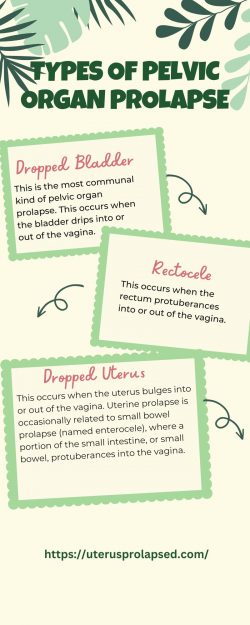 Types of Pelvic Organ Prolapse