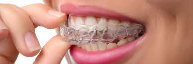 Dentist Invisalign Near Me | Invisalign Before And After Pictures