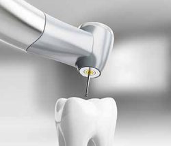 Affordable Dental Implants Clinic | sunnyislesdental
