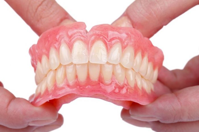 Dental Veneers In Uptown | gap in front teeth