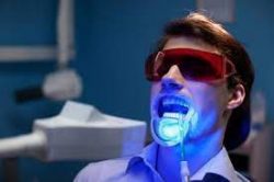 Laser Dentistry | Laser Teeth Whitening Near me