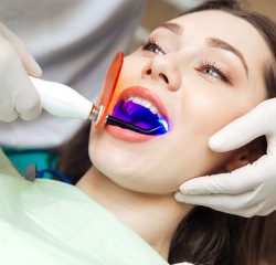 Laser Dentistry Near me | Laser Teeth Whitening Manhattan, NYC