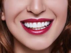 Cosmetic Dentistry Clinic – Veneers Dentist Houston