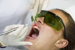 Cost of LANAP Dental Procedure