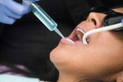 Dental Teeth Cleanings | dentist near me