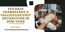 Follicular Unit Extraction: The Latest Hair Transplant Technique