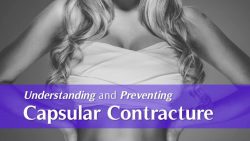 Capsular Contracture Treatment by Aspen After Surgery Center