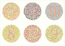 Color blindness and its signs