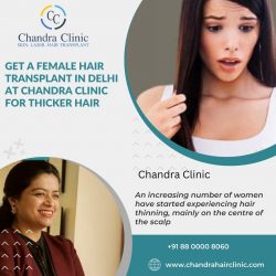 Get a Female Hair Transplant in Delhi at Chandra Clinic for Thicker Hair