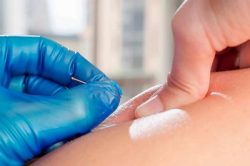 How painful is dry needling?