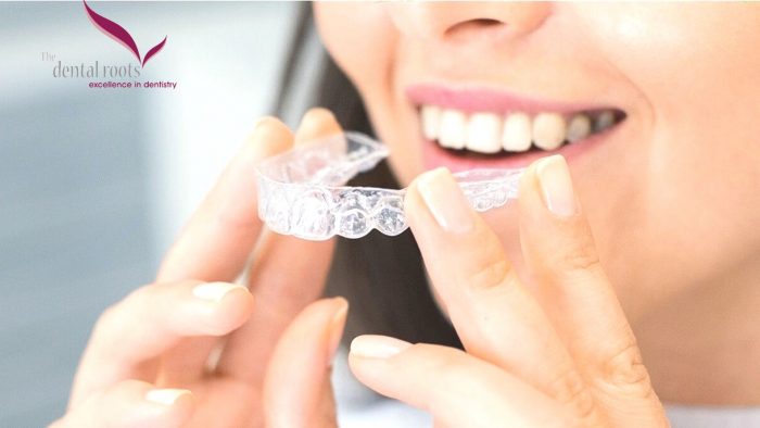 Invisalign Treatment in Delhi | TheDentalRoots
