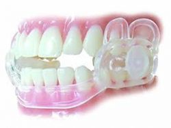Dental Night Guard For Teeth Grinding | Teeth Clenching