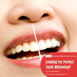 Looking For Perfect Teeth Whitening?