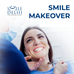 Smile Makeover Cost In India