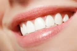 Teeth Whitening in Lancaster PA |Dillon Family Dentistry