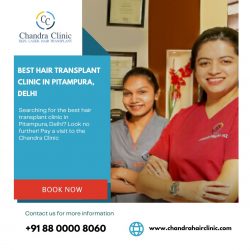 The Best Hair Transplant Clinic in Pitampura Delhi – Chandra Clinic