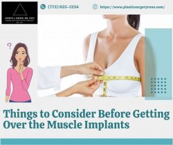 Things To Consider Before Getting Over The Muscle Implants