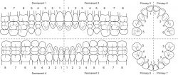 Dental Tooth Number Chart | Human Teeth Dental Charts
