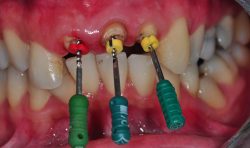 dentistopenonsaturday | What Is An Emergency Dentist?