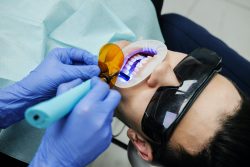 What Are The Advantages Of Deep Cleaning Teeth? | The Pros and Cons of Deep Cleaning Teeth