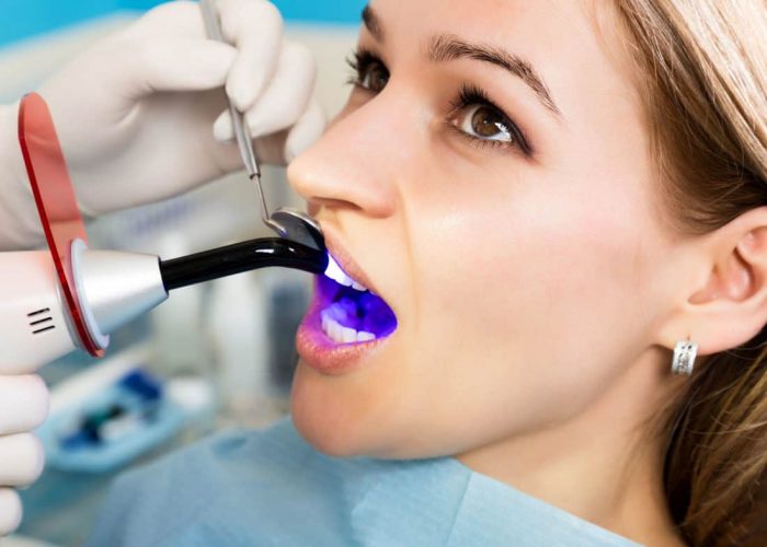 Reviews Of Advanced Laser Dentistry | Advanced Technology and Laser Dentistry