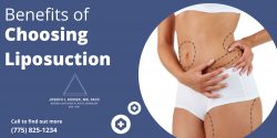 Benefits of Choosing Liposuction