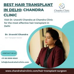 Best Hair Transplant in Delhi – Chandra Clinic