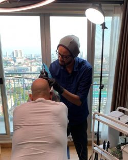 Best Scalp Micropigmentation Hair Loss Treatment in India